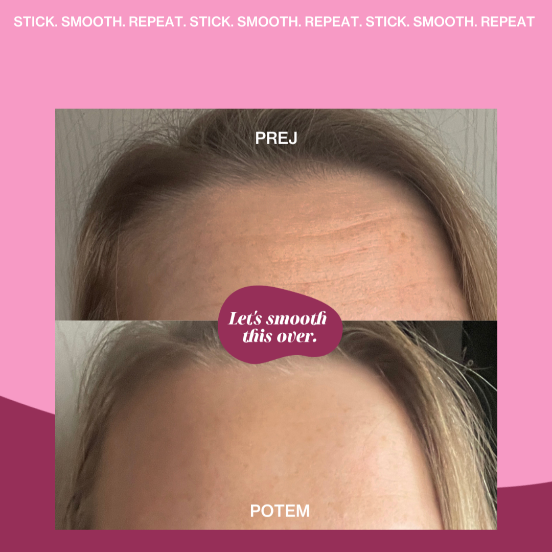 PAKET Silikonski obliž za čelo 3+1 GRATIS